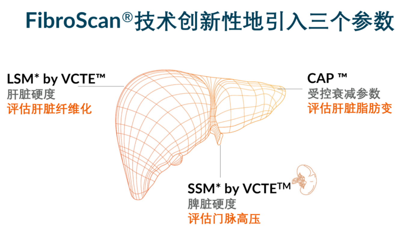 喜讯！FDA扩大了FibroScan®在肝脏综合管理中的应用范围