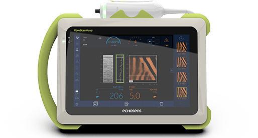 FibroScan HANDY®